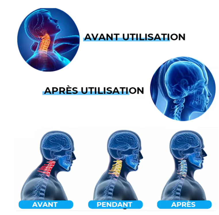 Avantages de l'oreiller cervical