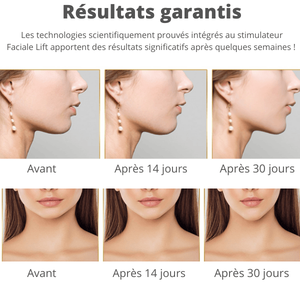 Appareil Lifting Visage RadiancePro™
