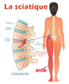 Comment Soigner une Sciatique ?