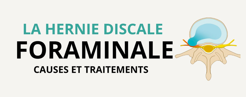 Hernie Foraminale :  Causes et traitements